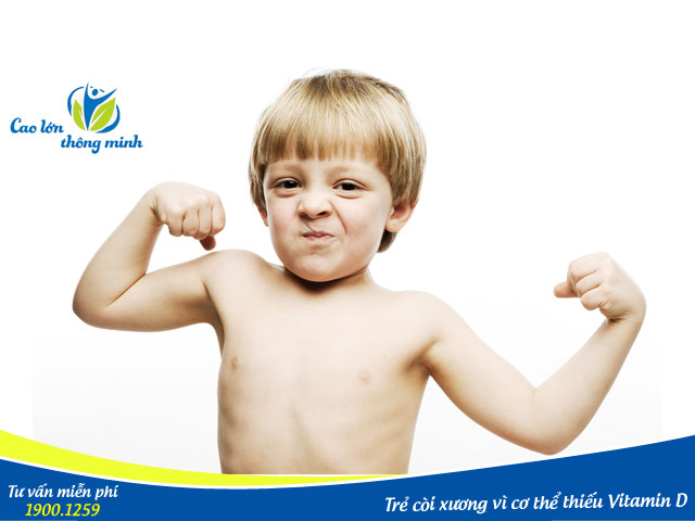 Còi xương là biểu hiện rõ ràng nhất khi trẻ thiếu Vitamin D